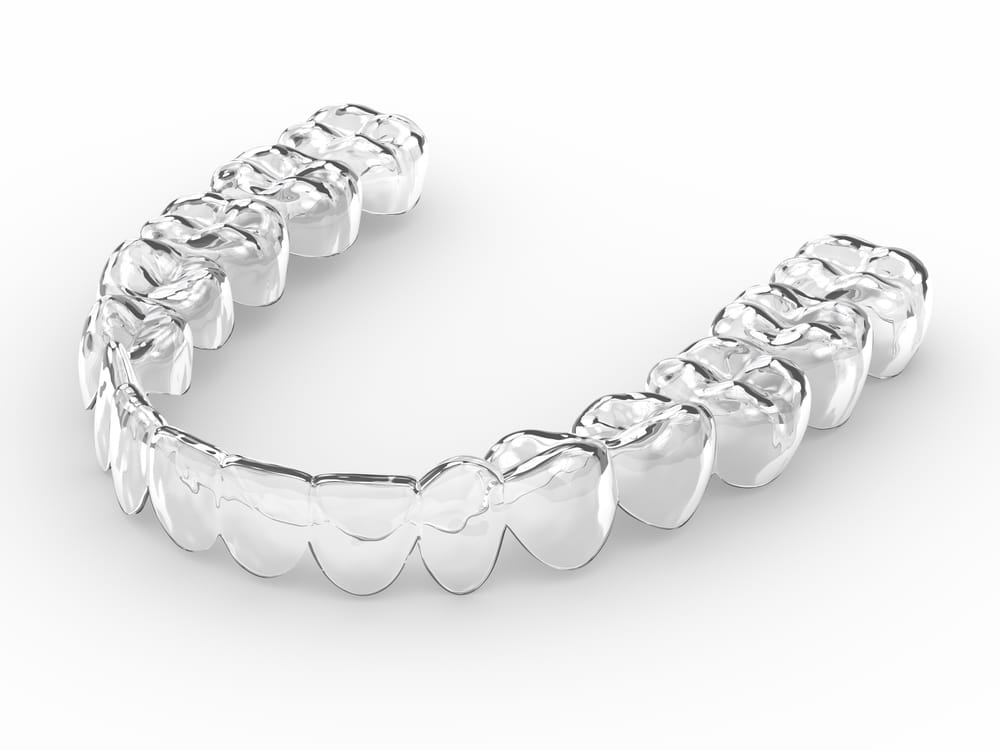 clear aligners image